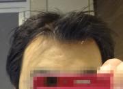 セットから13時間後