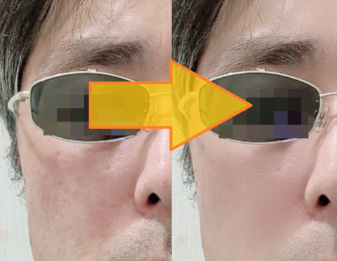 左が美肌0⇒右が美肌100(オサーンの顔を大きく写しても仕方ないので小さく)