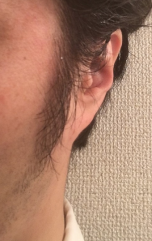 もみあげ刈る前