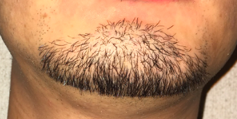 2.5mmに揃える前。