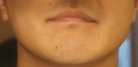 あっという間に全部剃れました