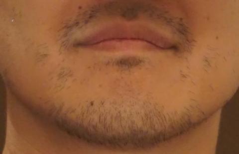 1週間伸ばした髭