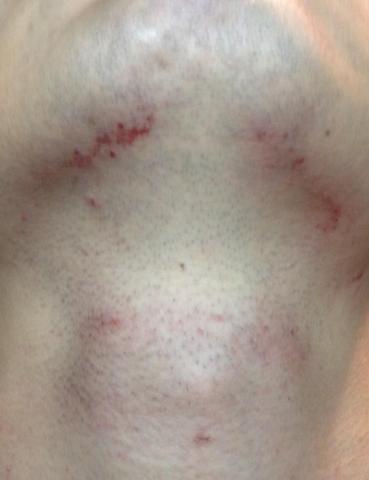 あご裏とのどの周りを剃ってみた