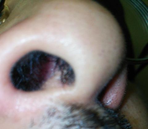 上段:before、下段:after