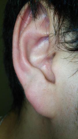 上:before、下:after