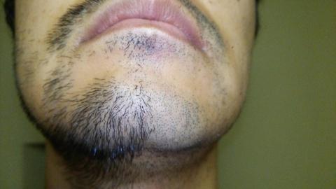 左:伸ばしたまま、右:0.3mmトリム