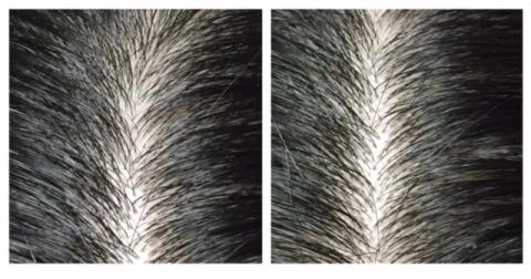 左:使用前 右:マッサージ約2週間後