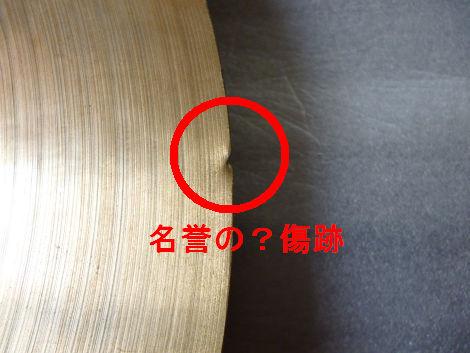 名誉の向こう傷?