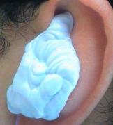 採取中はこんな感じ。ちょっとくすぐったいが、熱くも痛くもない。