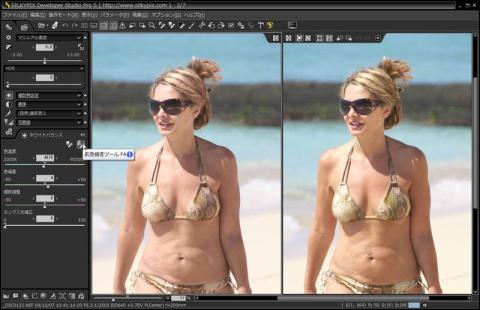 サンプル1|肌色の修正